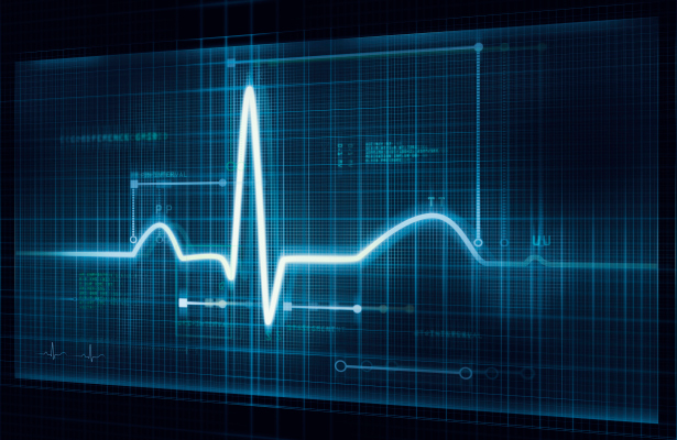 Cardiomatics bags $3.2M for its ECG-reading AI
