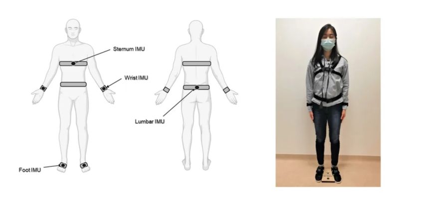 Study: Wearable sensors more accurately track Parkinson’s disease progression than traditional observation